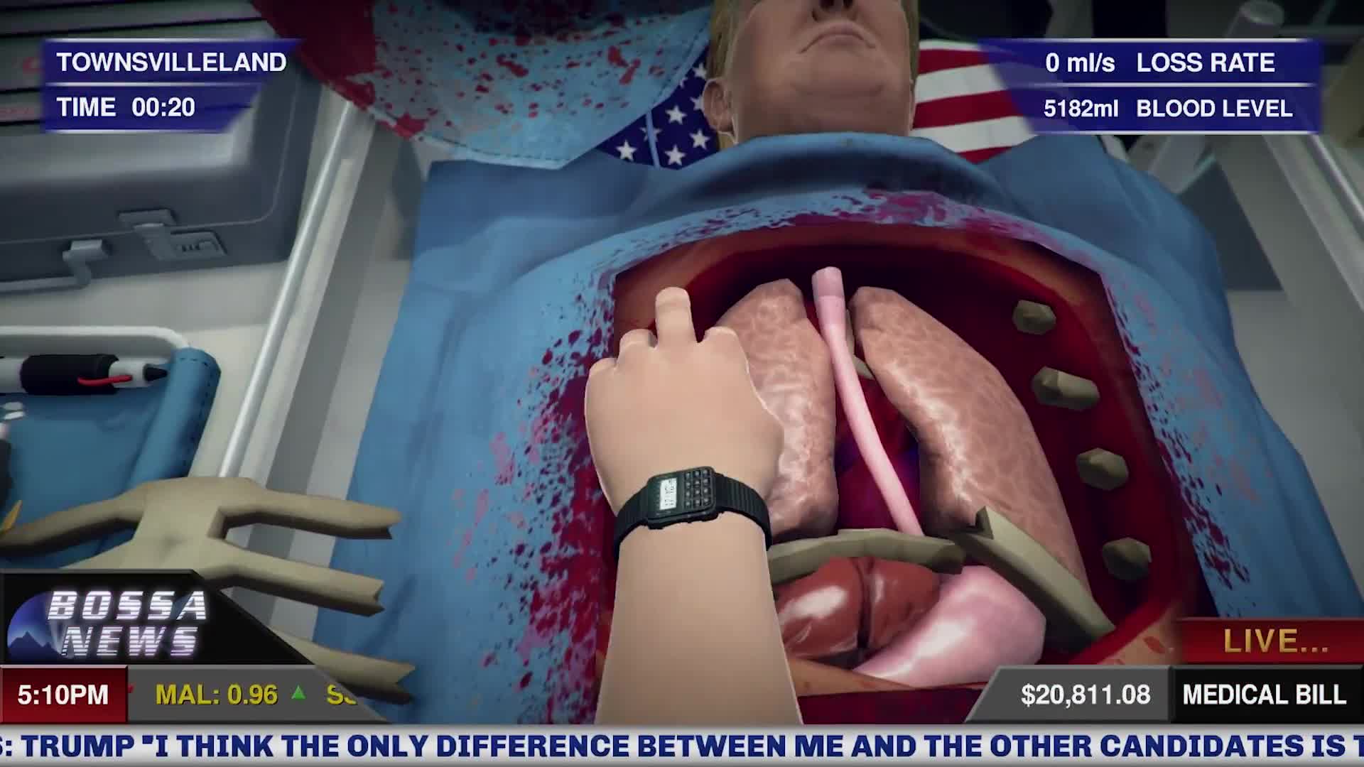 Surgeon Simulator: Inside Donald Trump  - Gameplay Trailer